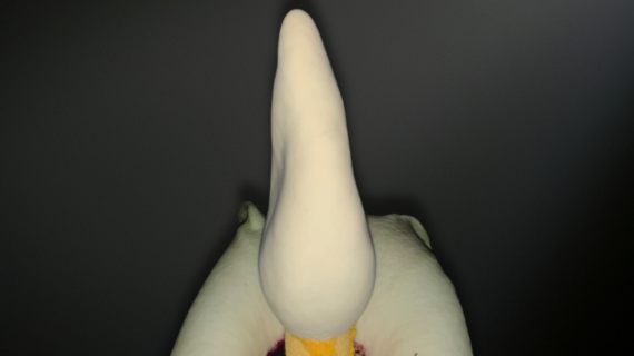 Amorphophallus prainii — A Shadowed Jewel of the Tropical Understory